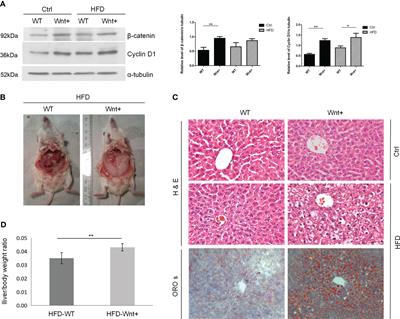 Wnt/β-catenin signaling activation promotes lipogenesis in the steatotic liver via physical mTOR interaction